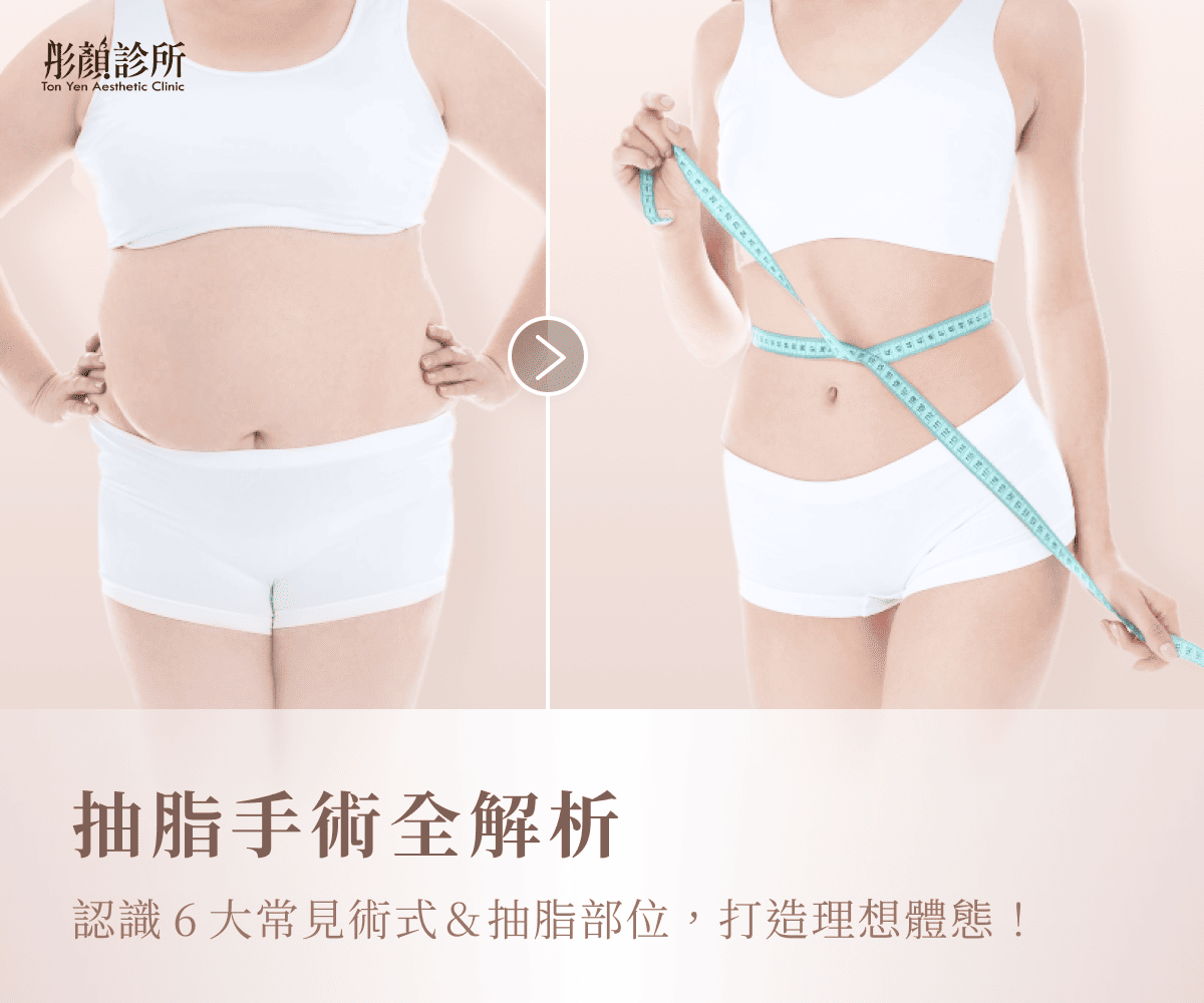 抽脂手術全解析：認識6大常見術式＆抽脂部位，打造理想體態！